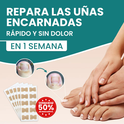 Recupera la confianza de unas uñas bonitas - NailsPatches